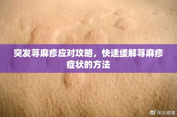 突发荨麻疹应对攻略,快速缓解荨麻疹症状的方法